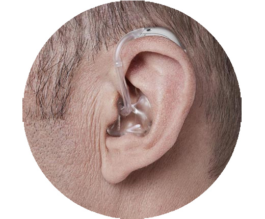 מכשיר שמיעה מאחורי האוזן